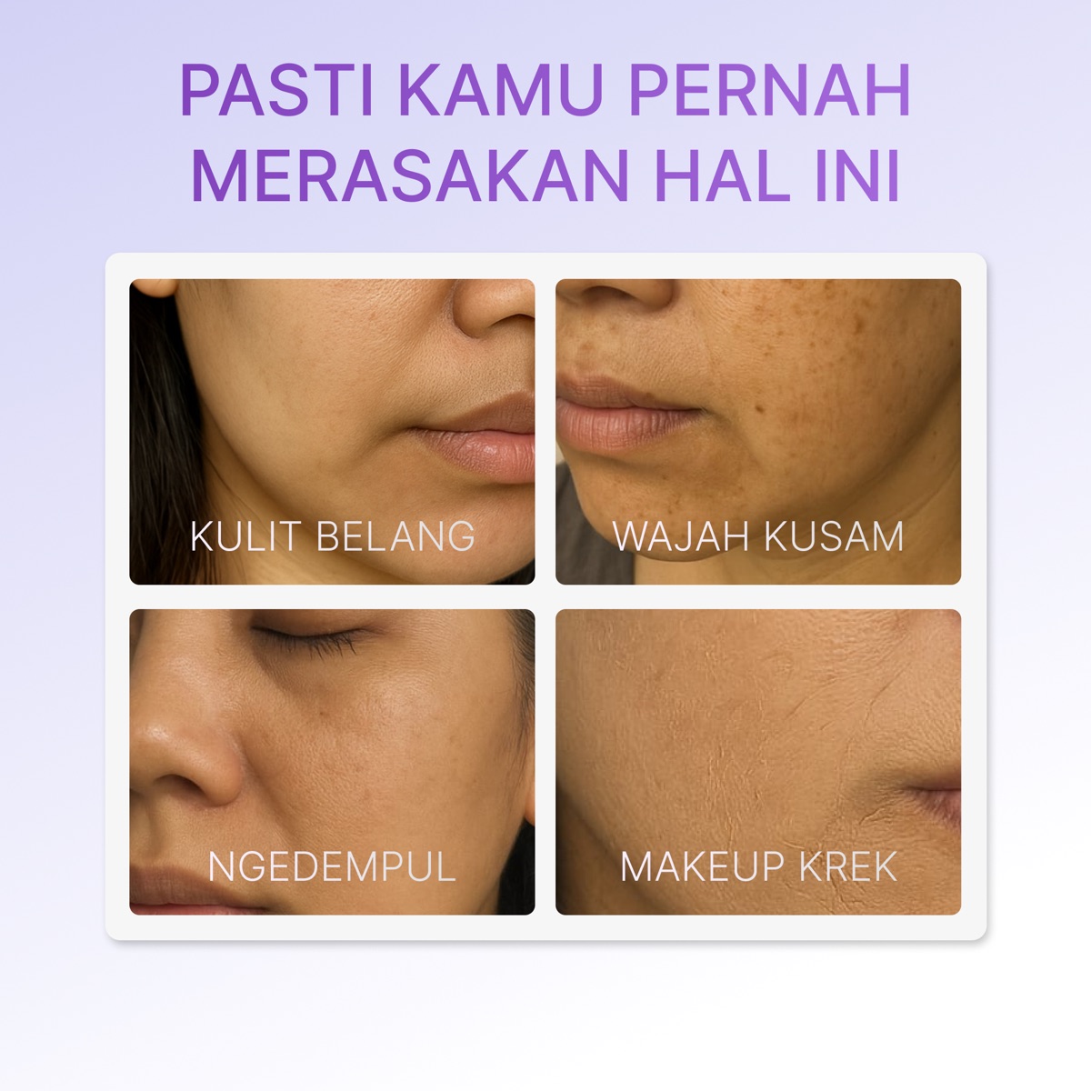 Ozzaskin Advanced Dark Spot Corrector Night Cream foto 2