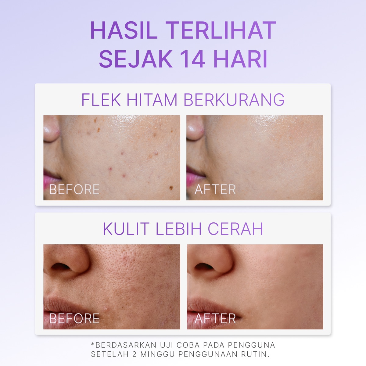 Ozzaskin Advanced Dark Spot Corrector Night Cream foto 6