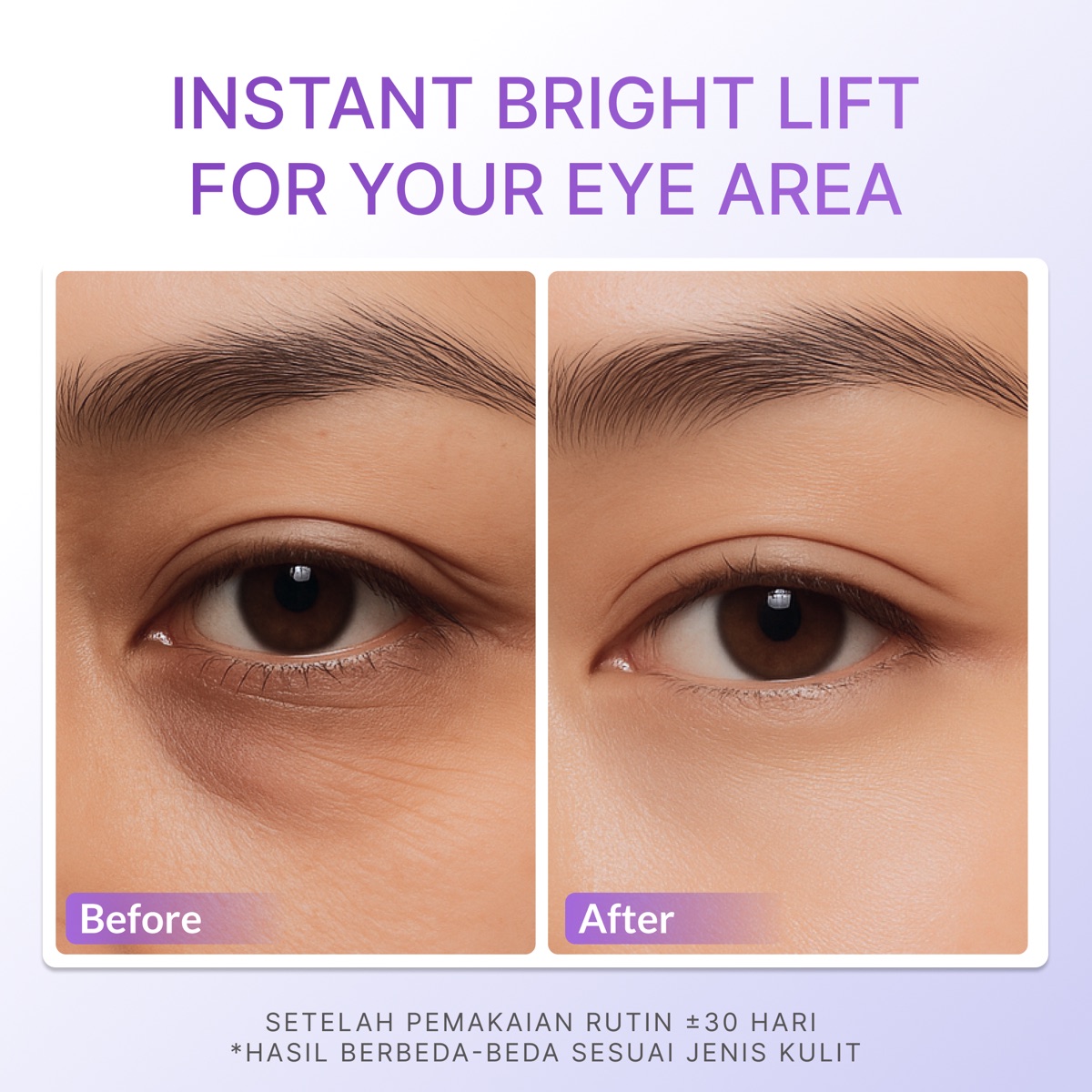 Ozzaskin Lifting & Brightening Eye Care Gel foto 7