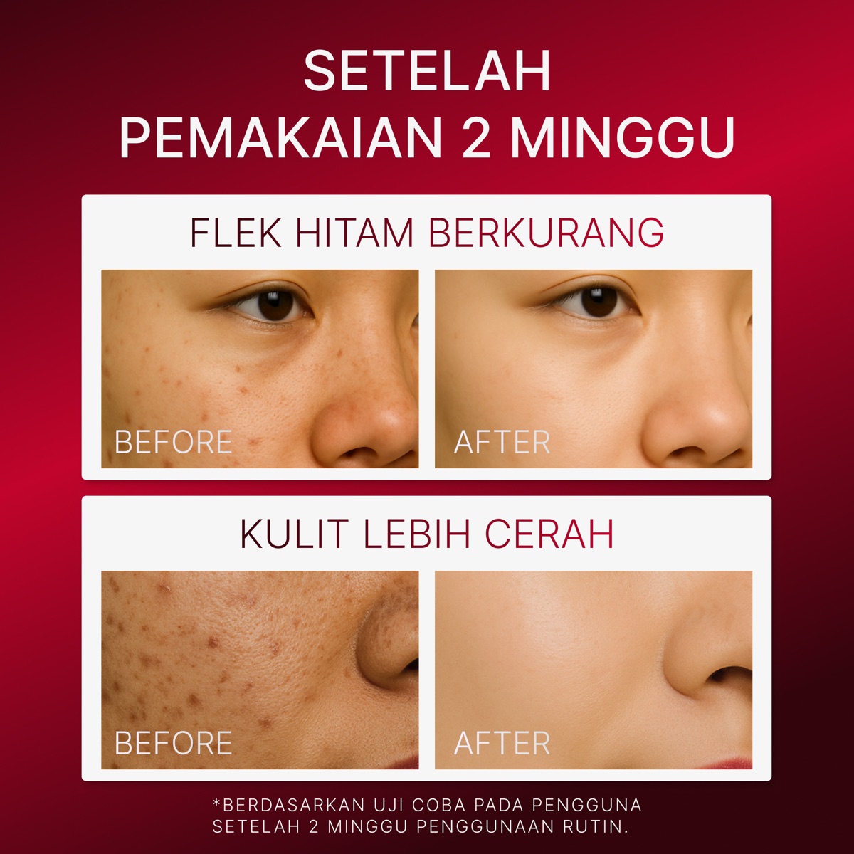 Ozzaskin Peeling Serum foto 8