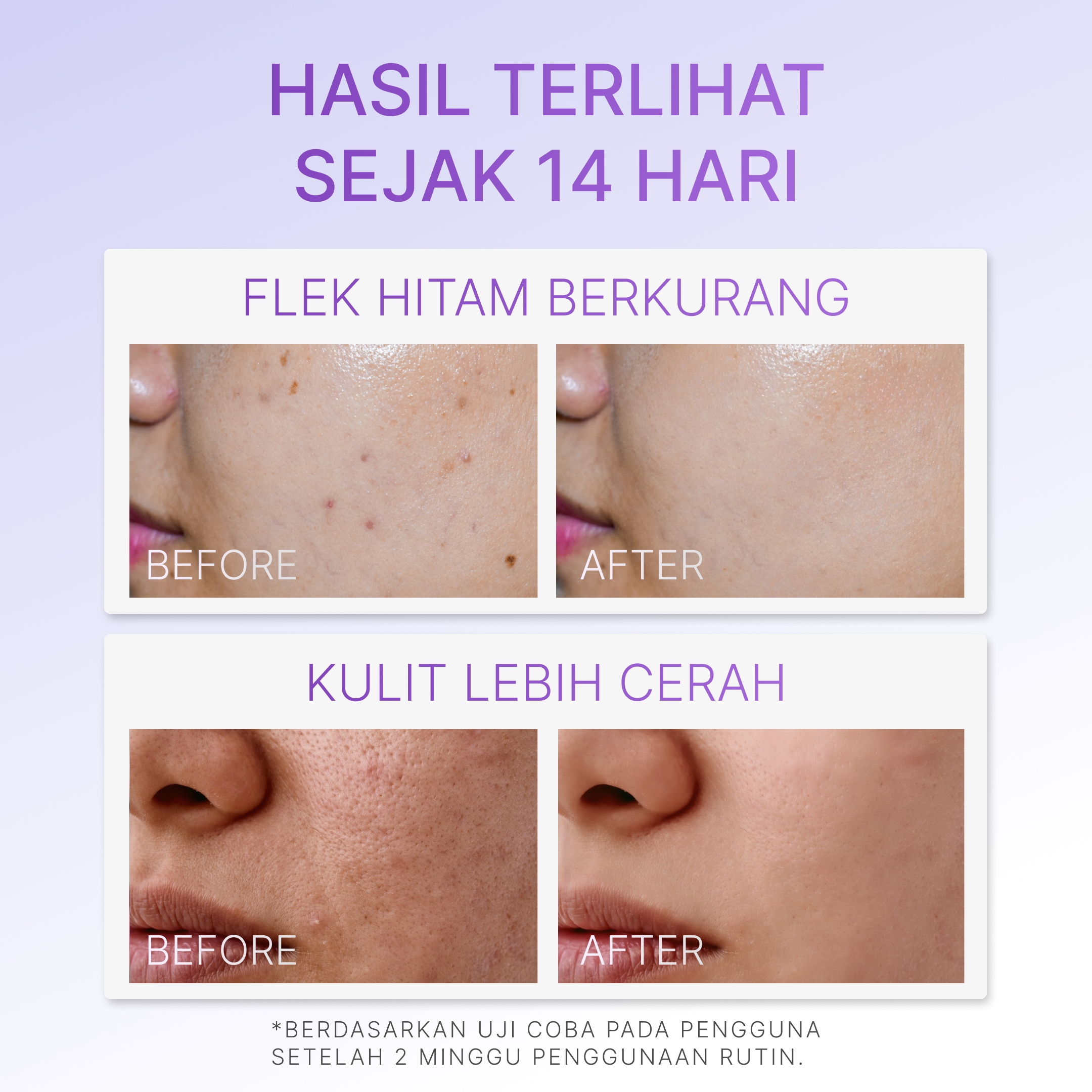 Ozzaskin Blur & Glow Skin Tint SPF 40 PA++++ 30g By Oki Setiana Dewi Halal BPOM Niacinamide 4% Membantu Mencerahkan, Meratakan Tampilan Warna Kulit, Memberikan Soft Glow, Blurring, Instant Tone-Up, Light Coverage & Perlindungan UVA UVB