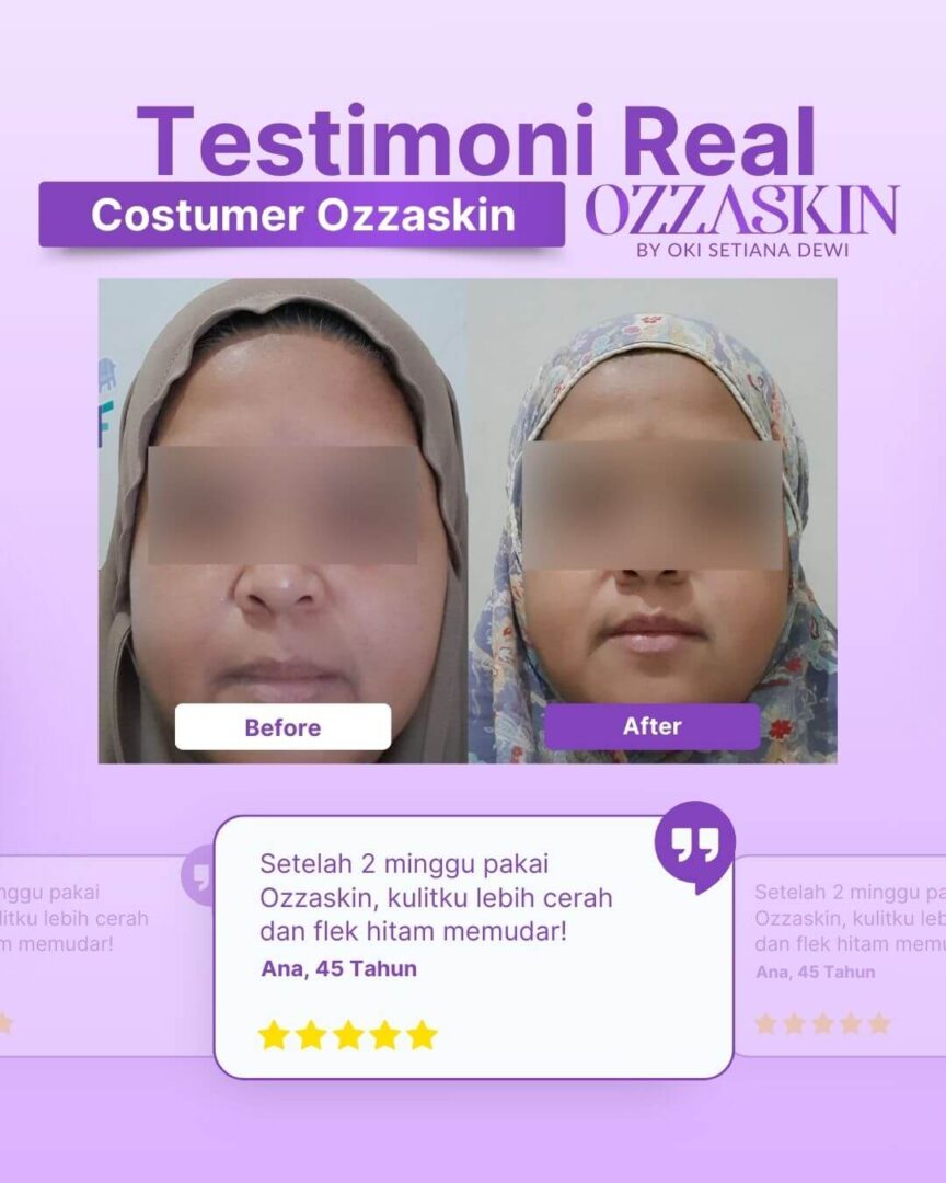 Testimoni produk ozzaskin (1) (1)