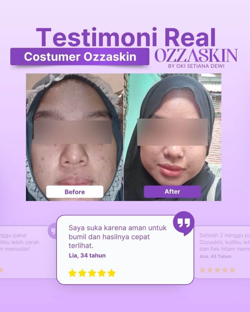 Testimoni produk ozzaskin (2) (1)